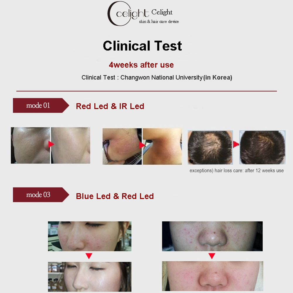 ch - Celight  Skin Care Device Beauty Equipment