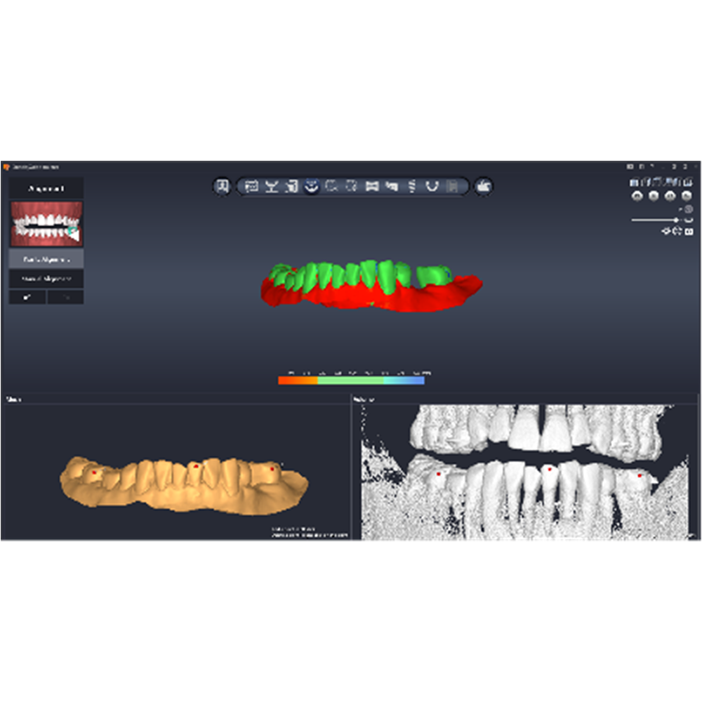 [3D Industrial] DentiqGuide