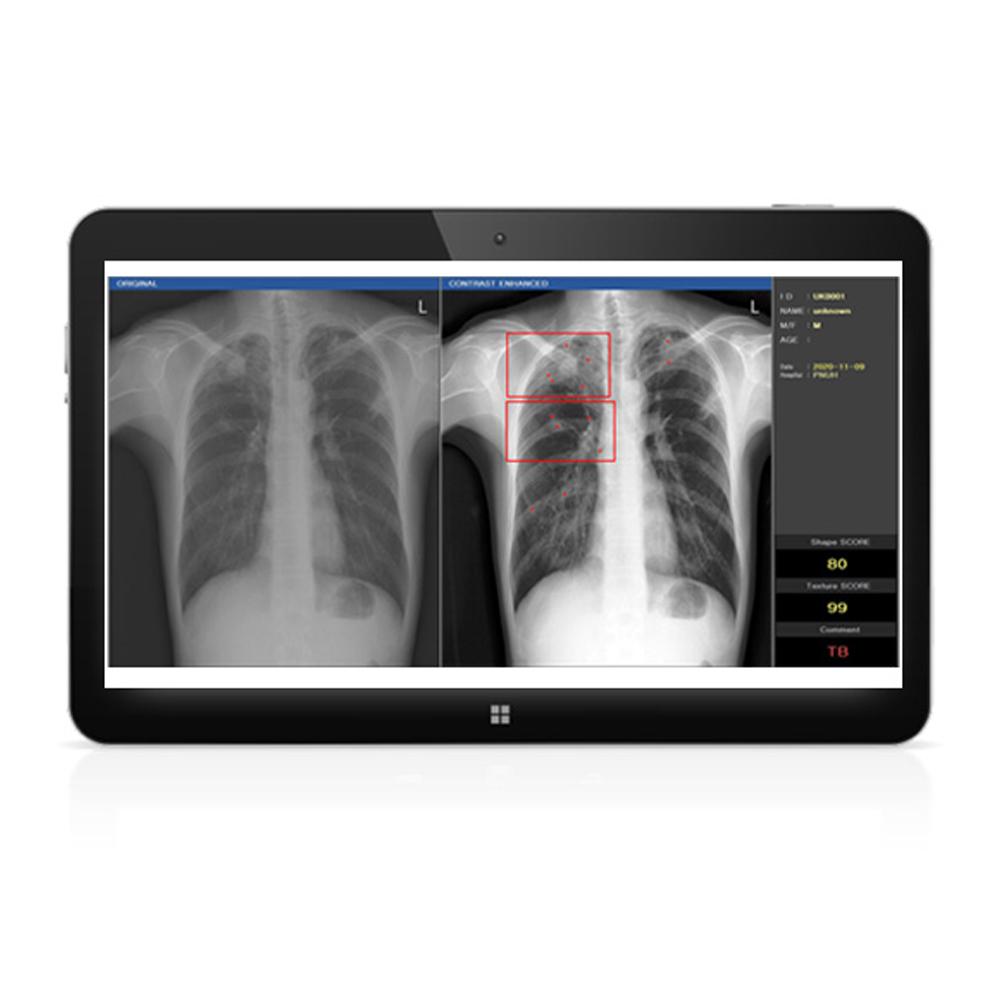 DxRAD(Digital X-ray Radiography Auto Decipher based on AI)