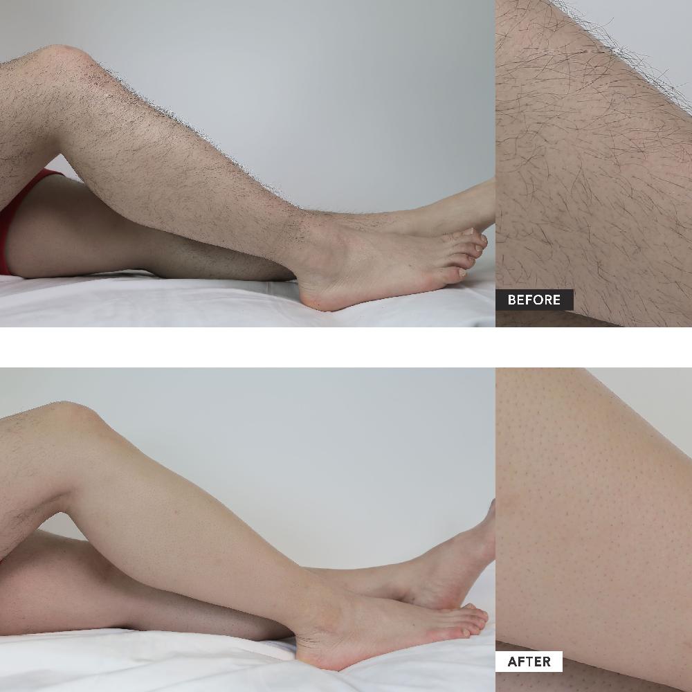 ALLIONE HAIR REMOVAL CREAM(JEJU CARROT/GANGHWA ARTEMISIA)